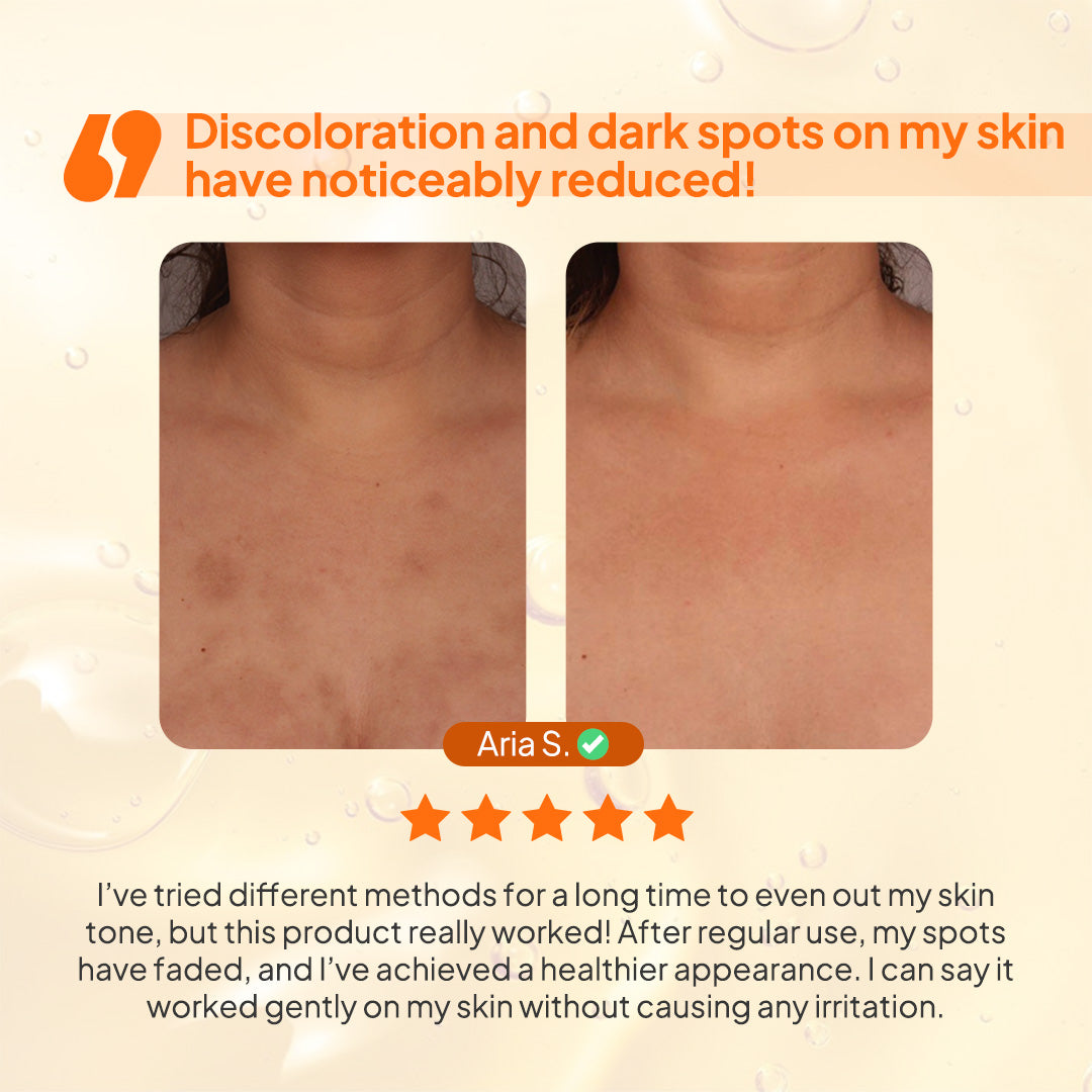 Kojic Acid Body Wash for Dark Spots