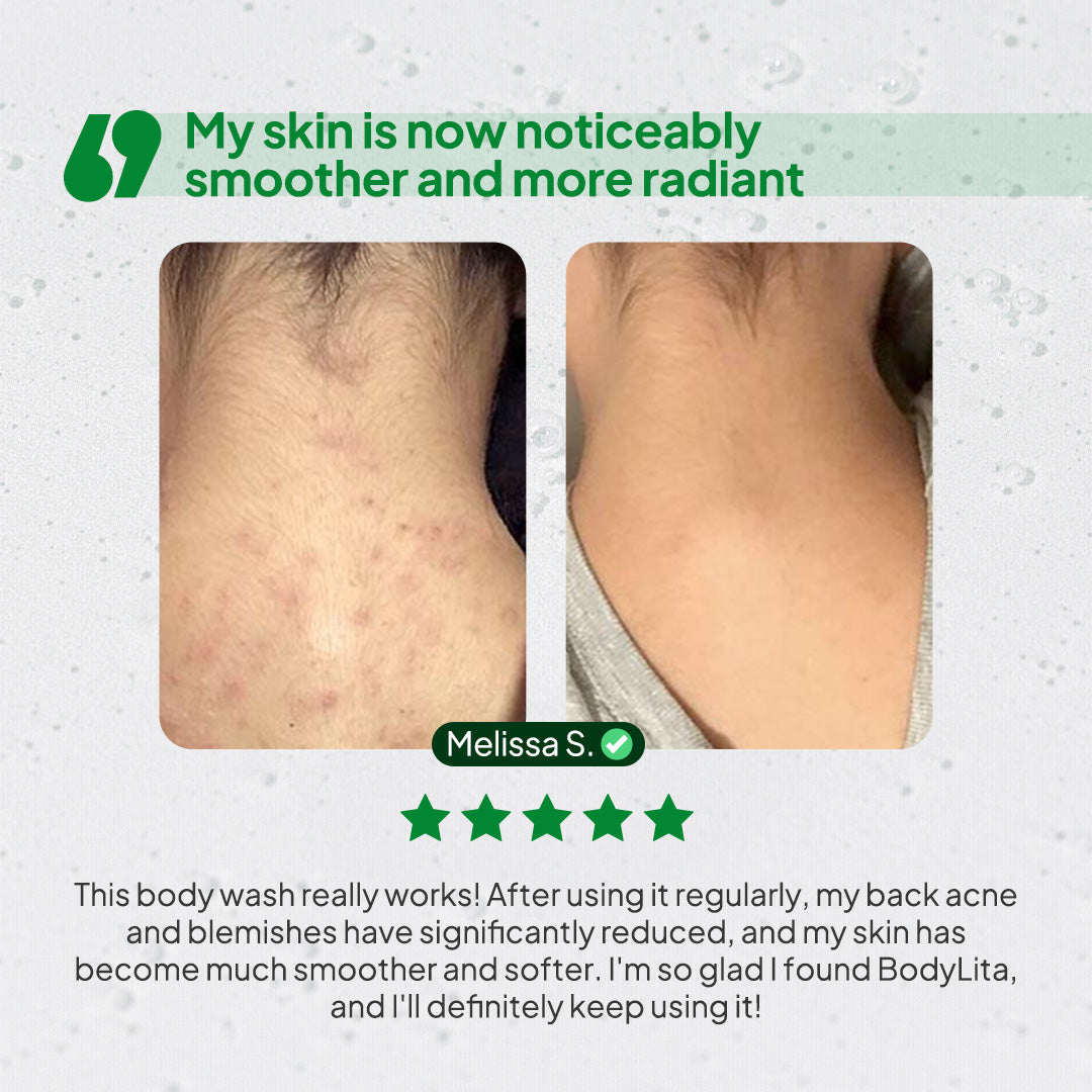 BodyLita Glycolic Acid and 6% Serum Body Wash