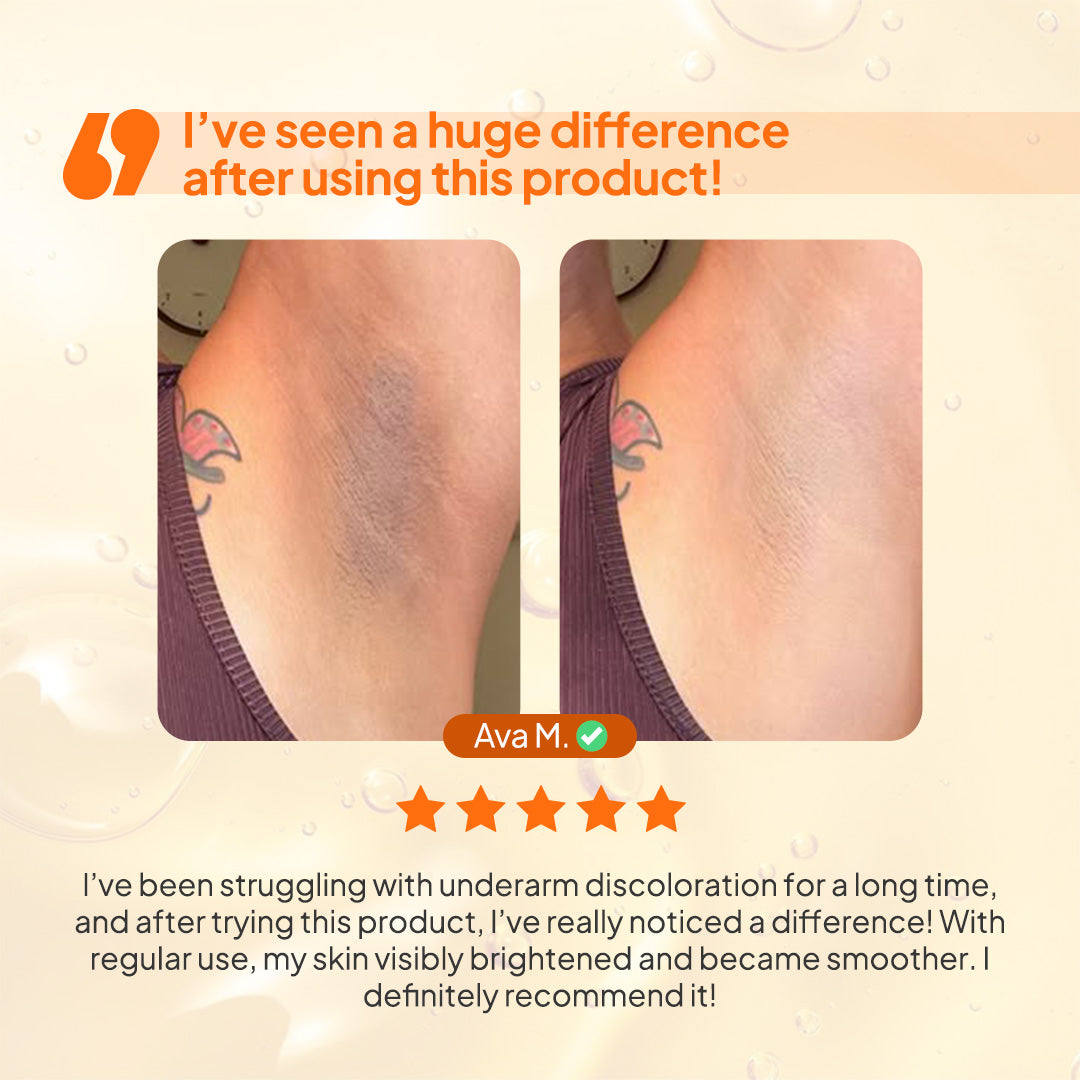 Kojic Acid Body Wash for Dark Spots