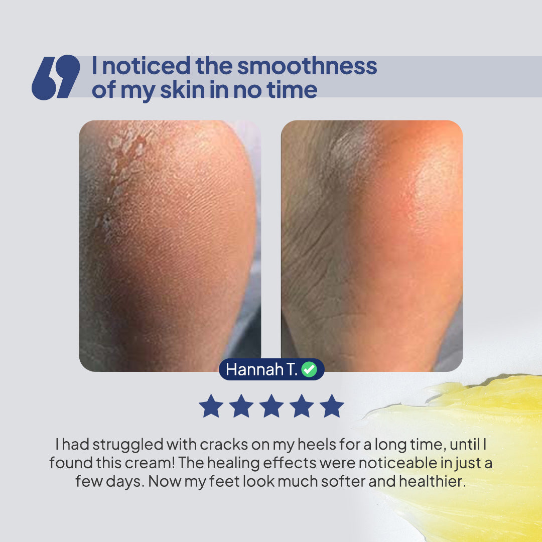 BodyLita Foot & Heel Crack Cream