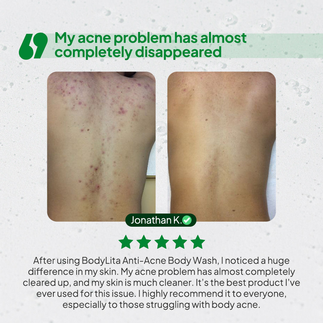 BodyLita Glycolic Acid and 6% Serum Body Wash
