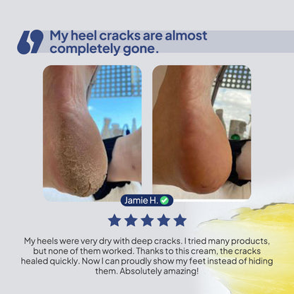 BodyLita Foot & Heel Crack Cream